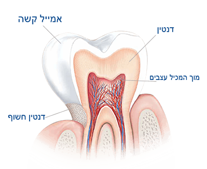 מה גורם לרגישות בשיניים?