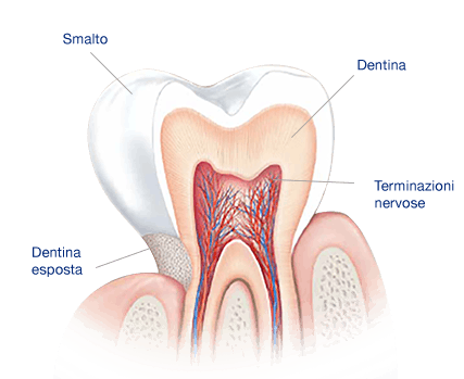 Ipersensibilità dentinale. Che cosa causa i denti sensibili?
