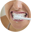 Behandelen van gevoelige tanden