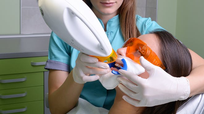 Tooth Whitening myths Header