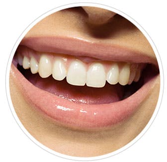 Wat zijn tanderosie symptomen en hoe kun je ze herkennen?