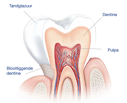Dankzij de structuur van je tand kun je tandglazuur niet herstellen