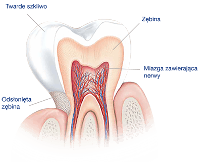 Co powoduje wrażliwość zębów?