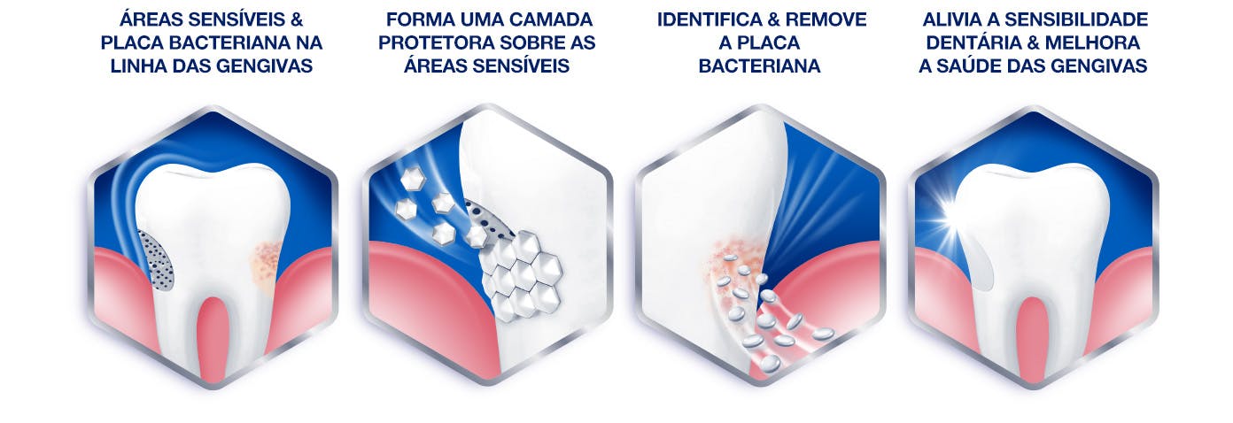 Solution complète pour vos gencives sensibles