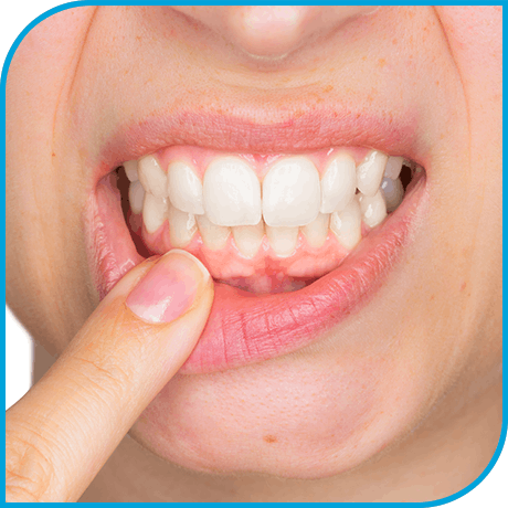 Gum Health and Sensitivity Gum Health and Sensitivity