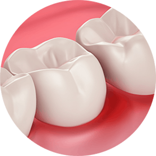 Здоровье десен и чувствительность зубов