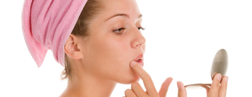 Girl with a cold sore on her inner lip Girl with a cold sore on her inner lip