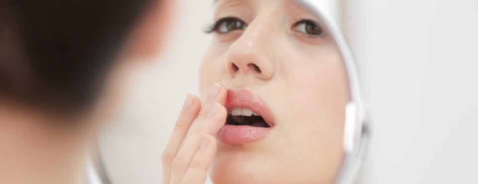Woman with cold sore looking into mirror Woman with cold sore looking into mirror