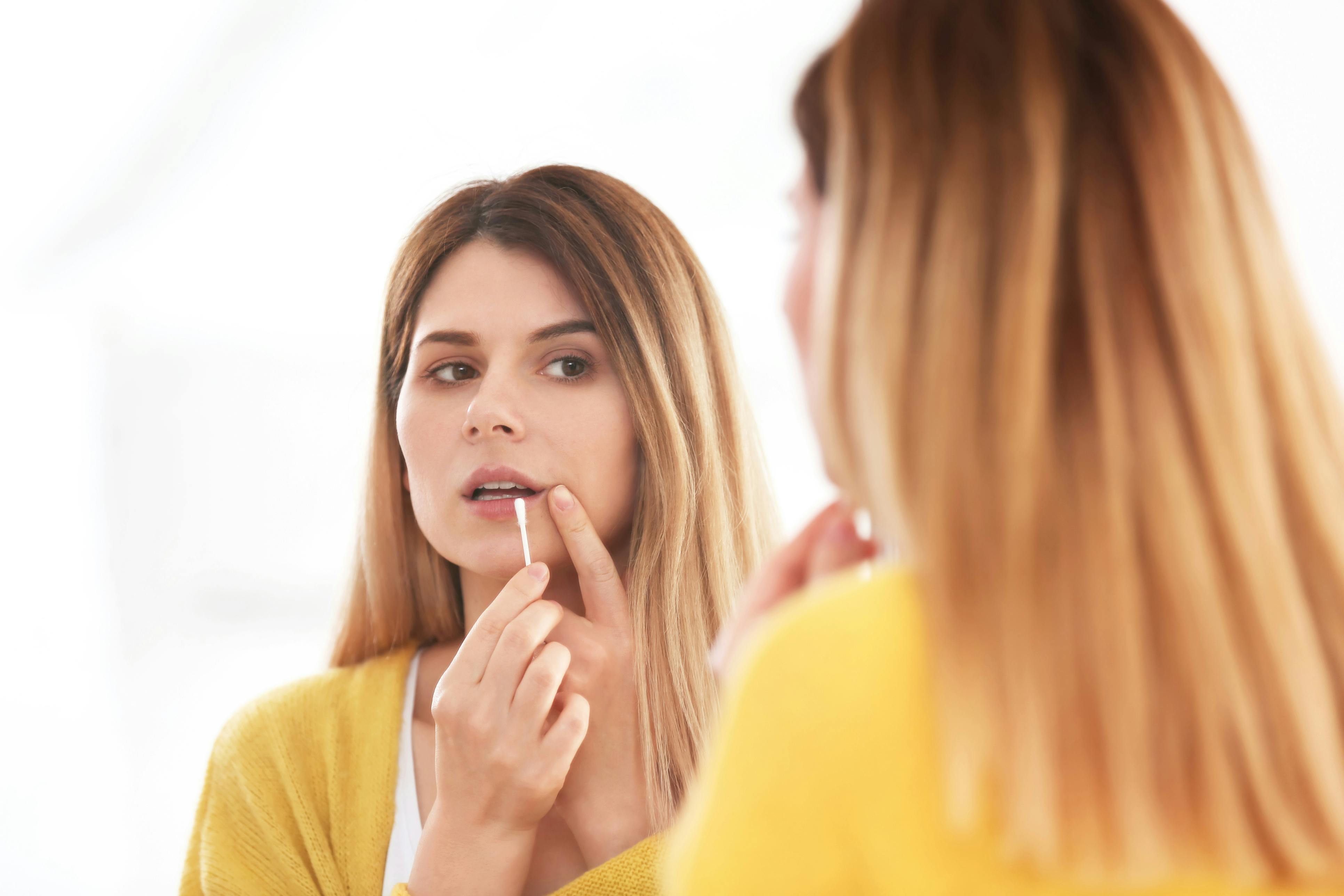 Woman looking in mirror applying Abreva cream to her lip