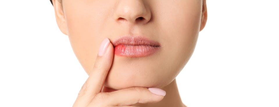 Mouth Pimples Causes: Managing Bumps on Lips