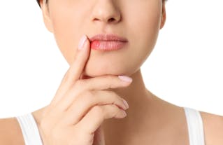 Woman with cold sore touching lips