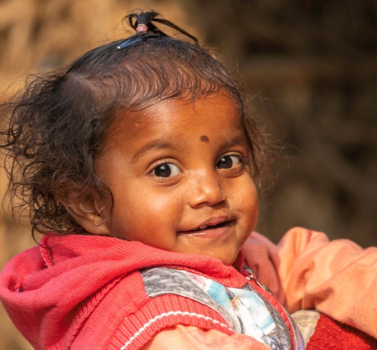 A child post cleft surgery, smiling