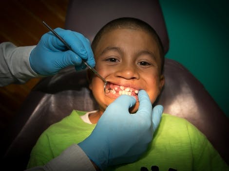 A child with cleft palate having a mouth inspection