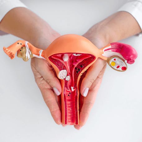 Ärztin hält Gebärmutter-Modell in den Händen.