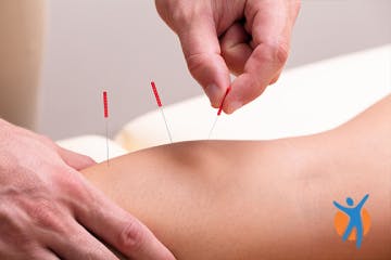 Acupuncturist applying needles as a complementary knee pain remedy