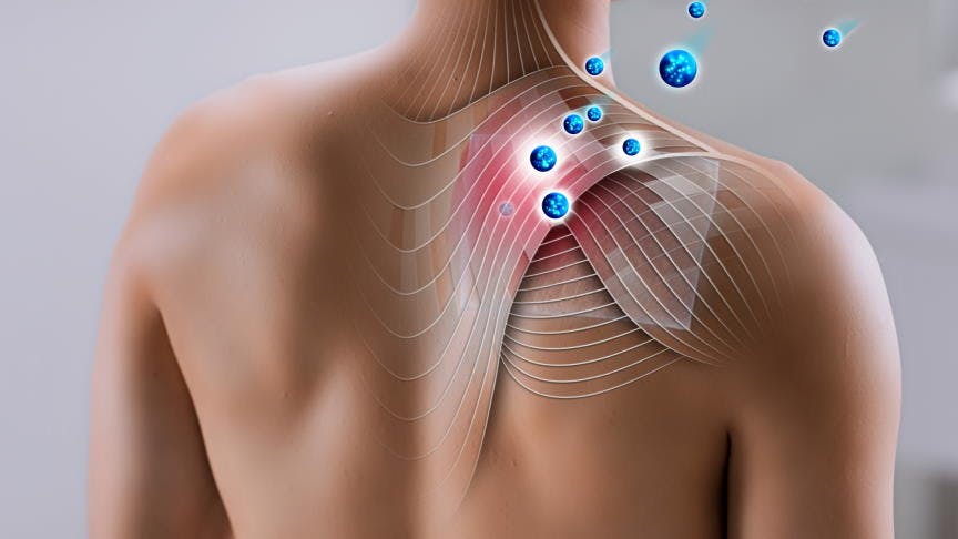diclofenac molecules working on pain affected upper right back