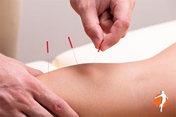 Knee pain treatment with acupuncture
