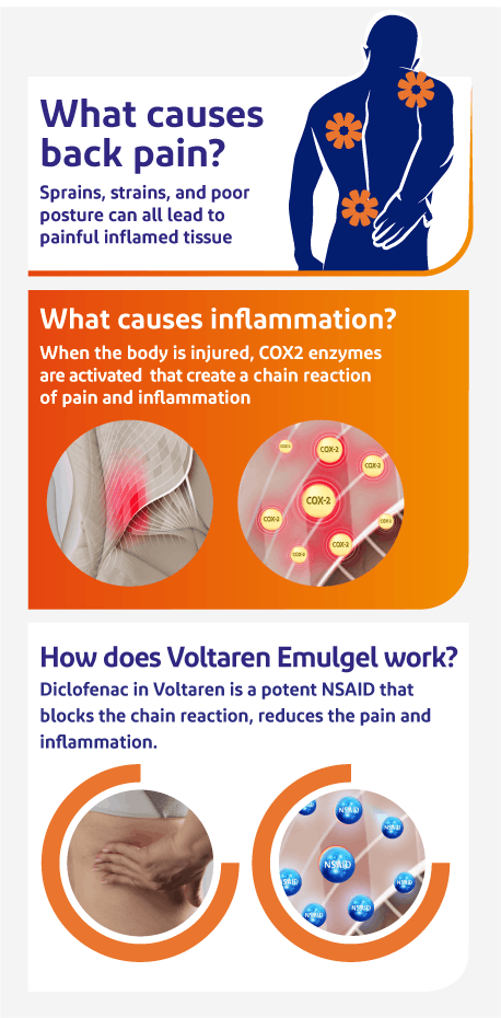 Infographic showing what causes back pain Infographic showing what causes back pain