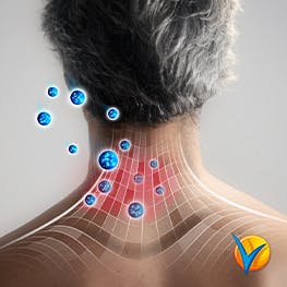 Gráfico mostrando como funciona Voltadol Gel en el cuello - Voltadol 