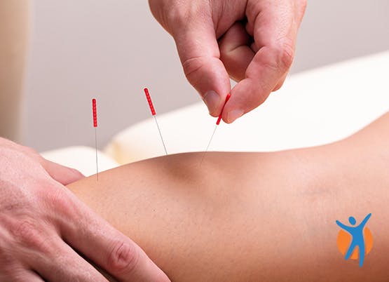 Acupuncture pour les douleurs au genou