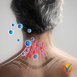 Grafik som visar hur Voltaren Gel fungerar på halsen