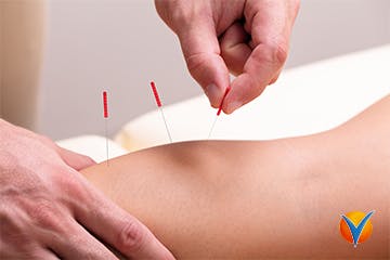 Akupunktur mot knäsmärta