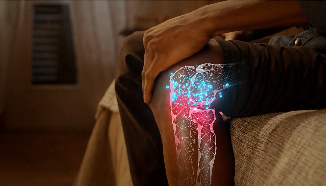 Dr. Rosen Prescribes Voltaren Gel Video