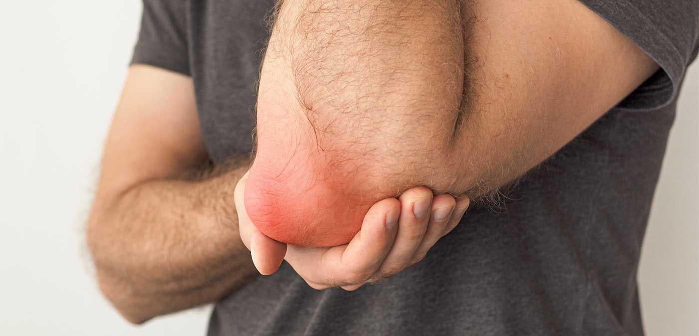 Man suffering from bursitis holds his elbow