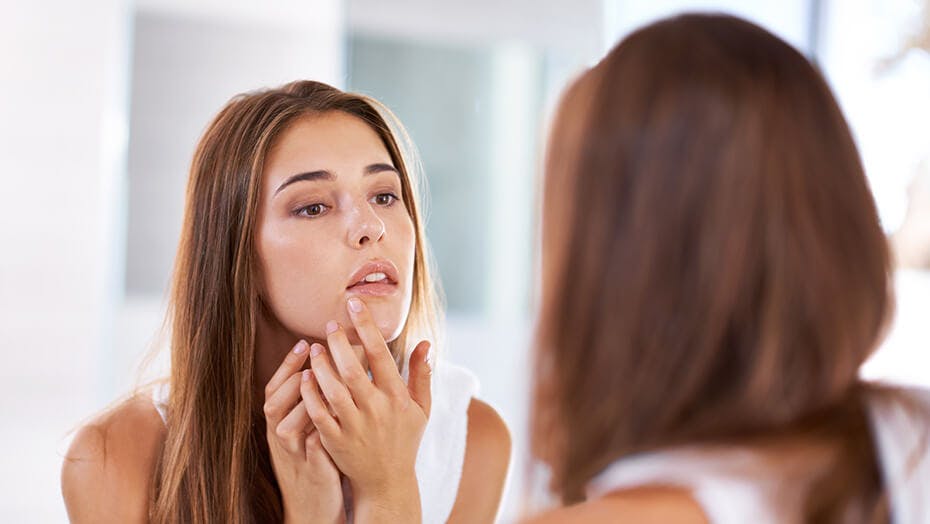 Woman looking at cold sore in the mirror