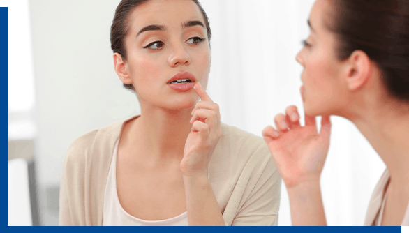 Young woman looking in mirror while applying Zovirax Cold Sore Cream Young woman looking in mirror while applying Zovirax Cold Sore Cream